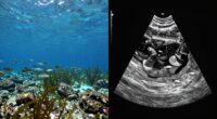 comparing side and down imaging